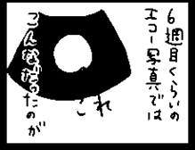 4コマ