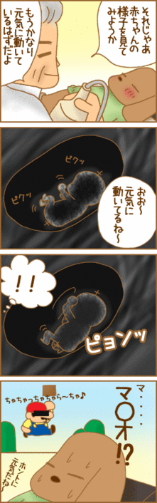4コマ